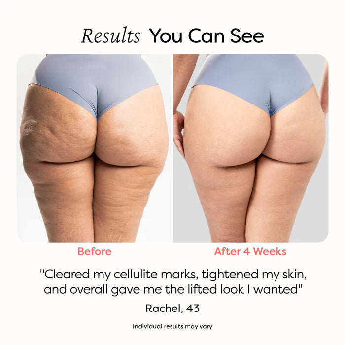Tone and Firm in 8 Weeks with Just 15 Minutes a Day from Home. Painless and Clinically Proven.