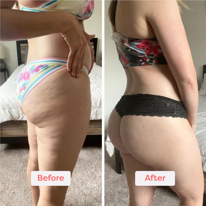 Tone and Firm in 8 Weeks with Just 15 Minutes a Day from Home. Painless and Clinically Proven.